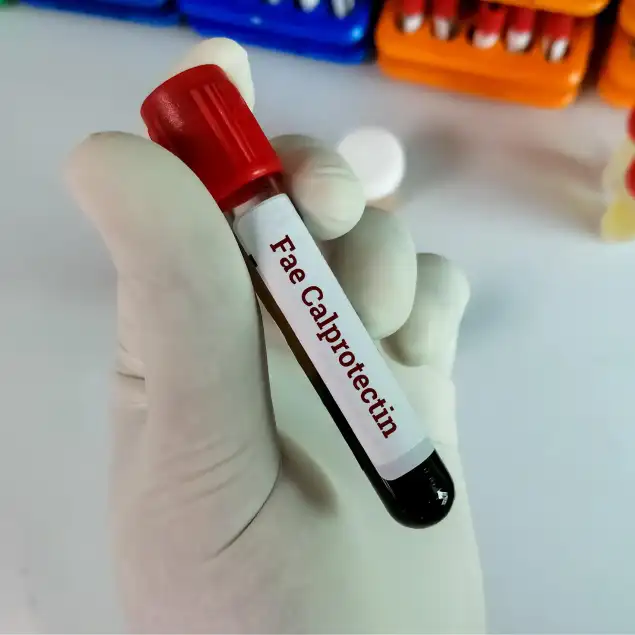 Bowel Cancer/blood In Stools Screen - LSDC Healthcare