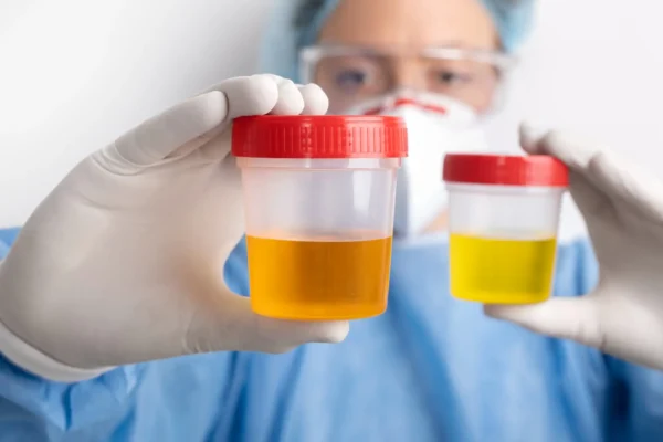 Blood in Urine (Haematuria)