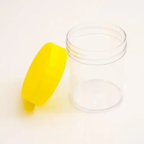 Urine Microscopy And Culture (UCEM)
